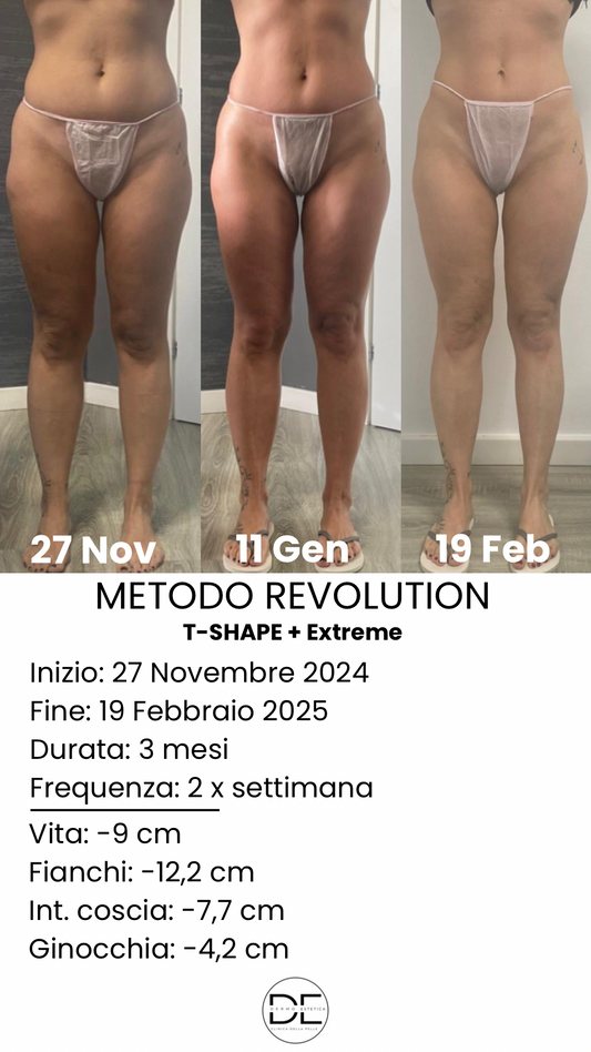 CELLULITE E RIDURRE CIRCONFERENZA