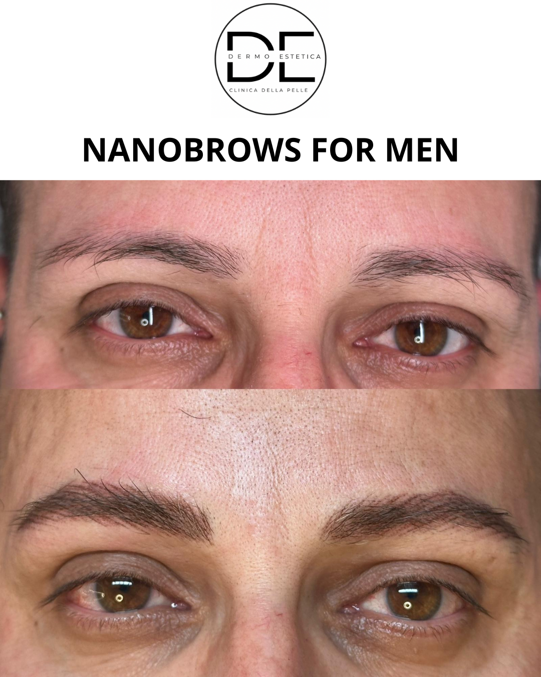 Tatuaggio Sopracciglia Uomo: Il Trend delle Nanobrows Iper Realistiche