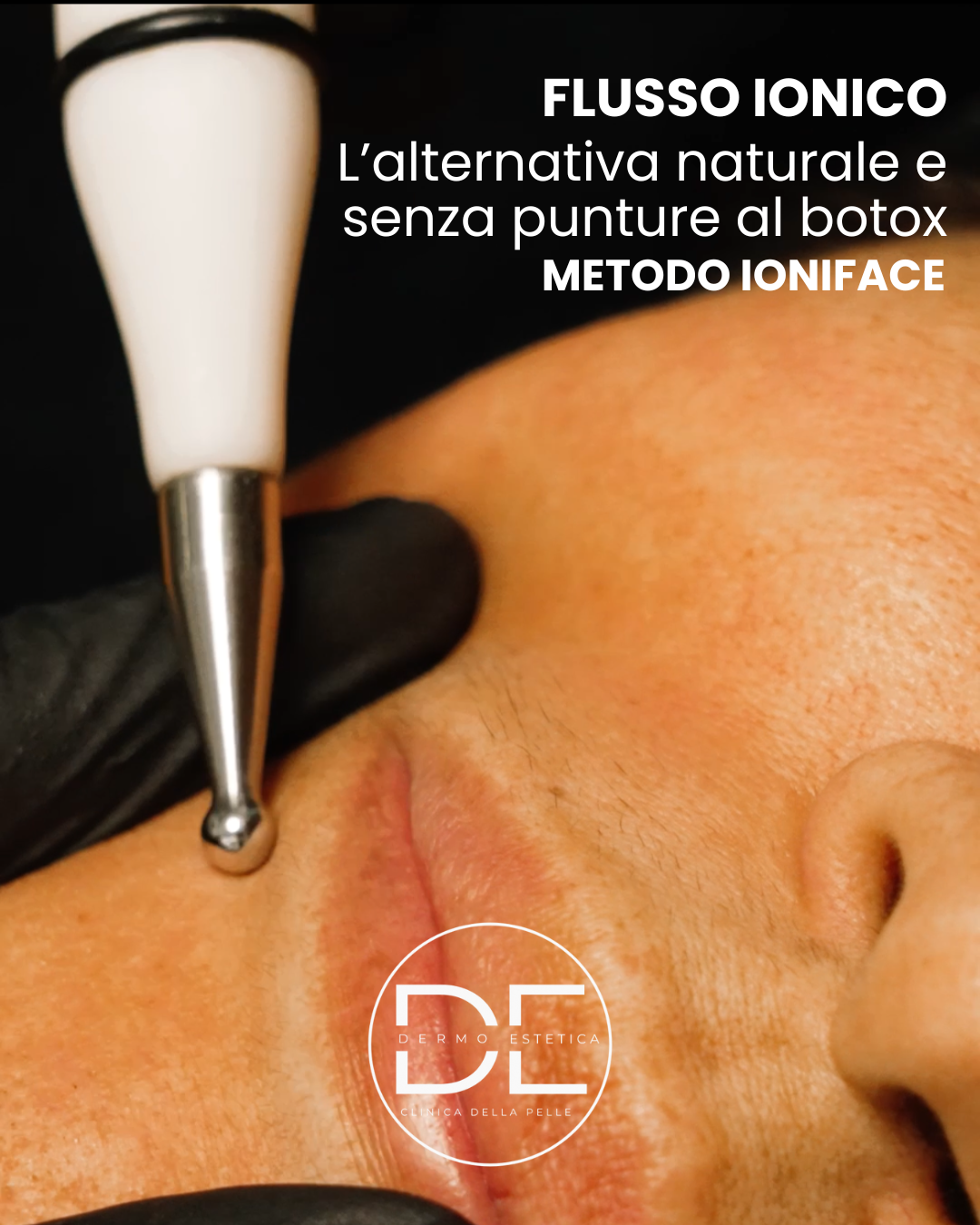 Flusso Ionico: Perché È Meglio del Botox per il Lifting Viso