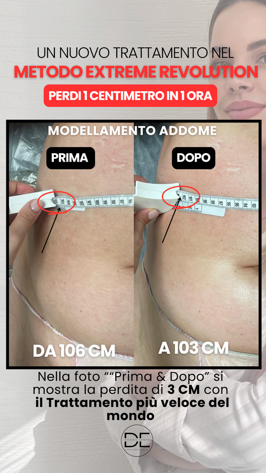 Metodo Extreme Revolution™: il protocollo clinico più rapido e tracciabile per il rimodellamento corporeo