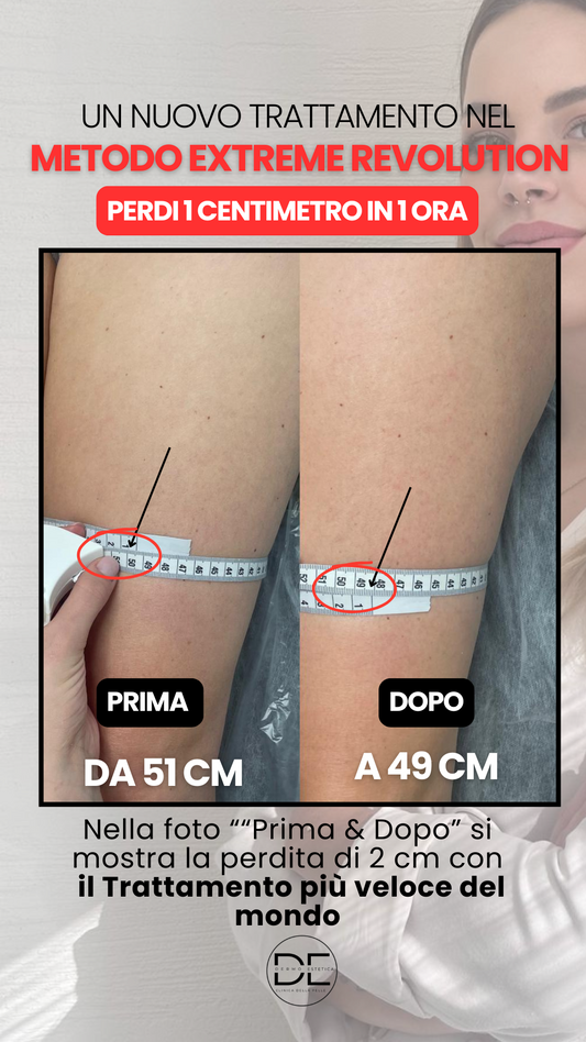 Perdi 1 cm in un’ora: il nuovo protocollo clinico che rimodella la silhouette in tempi record