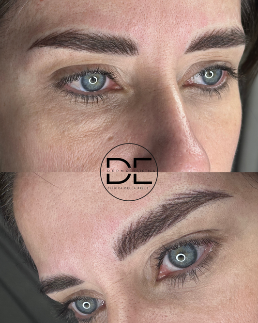 Sopracciglia Iper Realistiche: Il Tatuaggio Estetico Avanzato di Dimensione Estetica - La Clinica della Pelle a Varedo