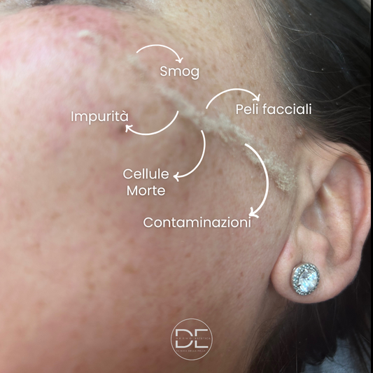 Dermaplain Plus: il trattamento viso che rinnova, illumina e rimpolpa la tua pelle